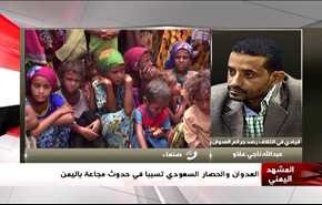 العدوان والحصار السعودي تسببا في حدوث مجاعة في اليمن - الجزء الاول