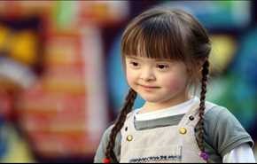 بريطانيا .. اختبار جديد للكشف عن متلازمة داون