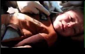 بالفيديو ..ألم وتضميد بدون تخدير لطفل الفوعة وكفريا السورية 