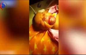 فيديو...  طفل يصدم والديه بعد ولادته مباشرة.. والسّبب مرعب!
