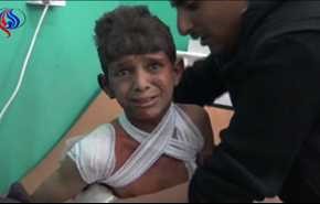 بالفيديو: الطيران السعودي يذبح اطفال اليمن..وتحذير اممي من موت صامت!