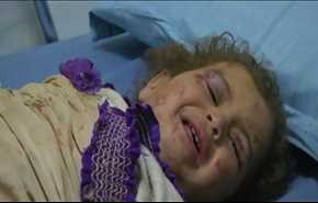 شاهد: غارات سعودية تشوه اطفال اليمن وتخنق حتى صرخاتهم!