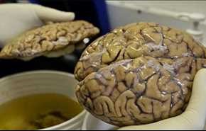 نگاهی به درون بزرگترین «بانک مغز» جهان