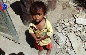 ميدل ايست: 18 مليون يمني على وشك الموت جوعا