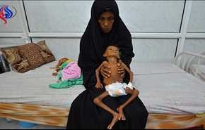 الفاو تحذر من كارثة إنسانية في اليمن بسبب المجاعة