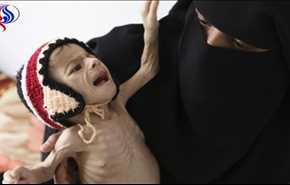 بحران گرسنگی و قحطی در یمن