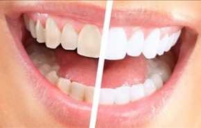بالفيديو .. كيف تحصل على أسنان بيضاء وخالية من الشوائب؟