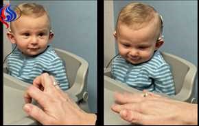 ویدیو... واکنش جالب کودک 10 ماهه ناشنوا بعد از شنیدن صدای مادرش