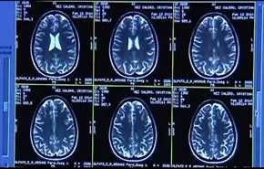 الرياضة وتاثيرها على الدماغ