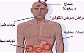 للأهمية .. هذه أعراض وطرق إنتشار وعلاج وباء (الكوليرا ) القاتل !