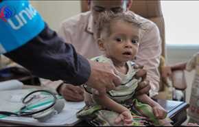 بالفيديو/ اليمن على شفى كارثة بسبب وباء الكوليرا .. من المسؤول؟
