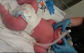 نيوزلندا تشهد ولادة طفل استثنائي