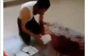 شاب تونسي يقطع شرايين يده لهذا السبب المفاجئ!