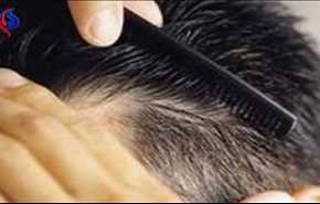 ابداع درمان های ریزش مو با سلول های بنیادی