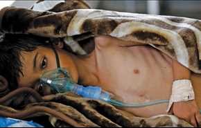 يونيسف تناشد العالم: 55 ألف حالة إصابة محتملة بالكوليرا في اليمن