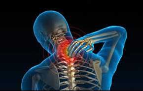 تخلص من آلام الرقبة فوراً بهذه الحيل الطبيعية!