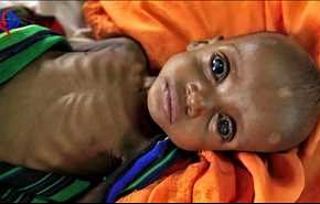 یونیسف: نیمی از مبتلایان به وبا در یمن کودک هستند