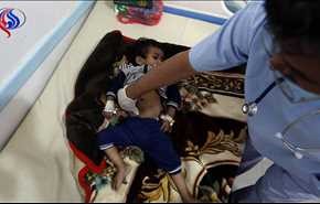 فيديو؛ تسجيل 150 ألف اصابة بالكوليرا في اليمن و40% منهم اطفال