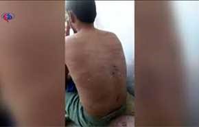 فيديو ليمني تعرض للتعذيب بسجن تديره الإمارات