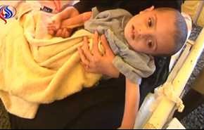 بالفيديو: سنتان من العدوان .. وباء الكوليرا يفتك بالمدنيين ربعهم اطفال