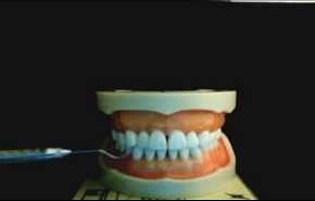 تنظيف الاسنان