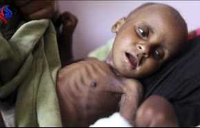 بالفيديو.. 795 مليون شخص حول العالم يصرخون جوعاً وفي مقدمتهم أطفال اليمن