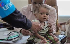 كوليرا آل سلمان: طفل يمنيّ يصاب كل 35 ثانية!