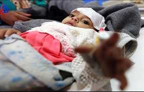 الجمهورية اليمنية تدعو المجتمع الدولية للتحرك الجاد لمجابهة الكوليرا