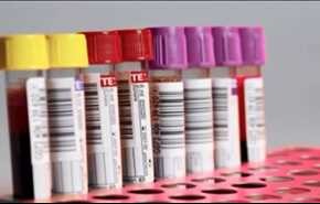 فقر الدم ..اسبابه وعلاجاته