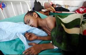 الأمم المتحدة: انهيار كامل للنظام الصحي باليمن