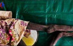 الكوليرا تحصد 14 شخصا في شمال شرق نيجيريا