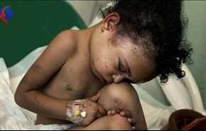 نيويورك تايمز: السعودية ترتكب جرائم حرب في اليمن بتواطؤ أميركي-بريطاني