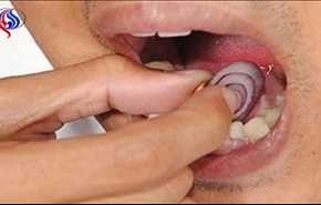 ماذا يحصل إذا وضعتم شريحة من البصل على أسنانكم؟!