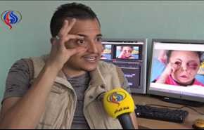 شاهد.. مصور قناة العالم يكشف خفايا الصورة التي التقطها للطفلة اليمنية 