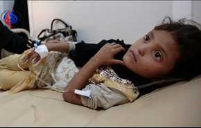 اليونسيف: إصابات الكوليرا في اليمن تتجاوز 680 ألف حالة