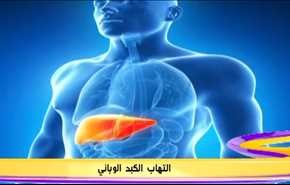 الالتهاب الكبد الوبائي