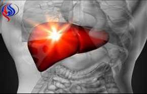 أعراض الكبد الدهنى وأسباب الإصابه به