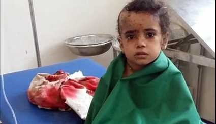 A Cry for Help: Millions Facing Famine in War-Torn Yemen