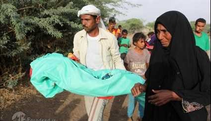مرگ دختر یمنی بر اثر سوءتغذیه+تصاویر