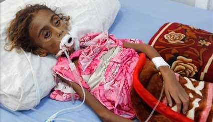 Seven-year-old Yemeni girl dies of malnutrition