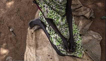 انتشار وباء في جنوب السودان