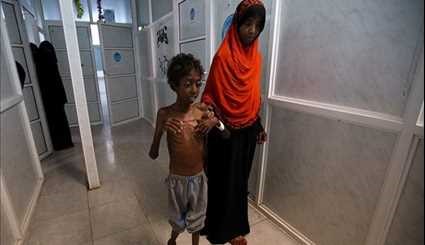 Yemen Cholera Epidemic: Death Toll Nears 1,000