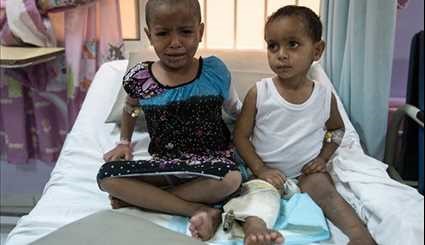 Horrors of Yemen's Spiralling Crisis