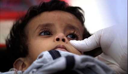 شدیدترین نوع وبا در یمن +عکس