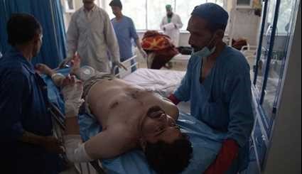 24 Killed, 42 Wounded after Car Bomb Strikes Minibus in Kabul