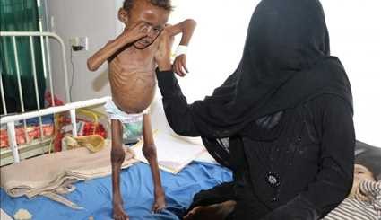 Going hungry in Yemen