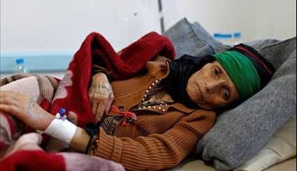 Out of Control Yemen’s Cholera Epidemic World’s Worst