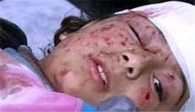السلطات البحرينية تستخدم اسلحة محرمة دوليا لقمع المتظاهرين