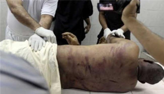  رفع دعوى الى محكمة العدل الدولية لملاحقة النظام البحريني