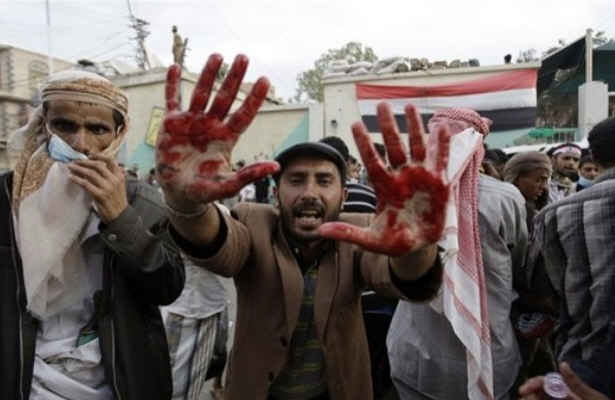 حمله گارد عبدالله صالح به تظاهرکنندگان